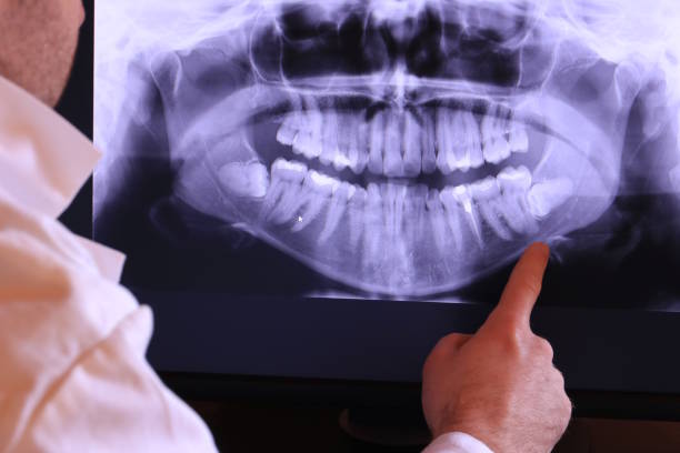 Best 24-Hour Emergency Dentist in Angier, NC