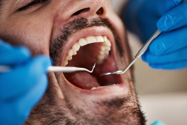 Best Walk-In Emergency Dentist in Angier, NC