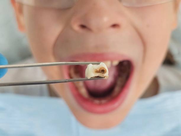 Best Emergency Treatment for Toothache in Angier, NC