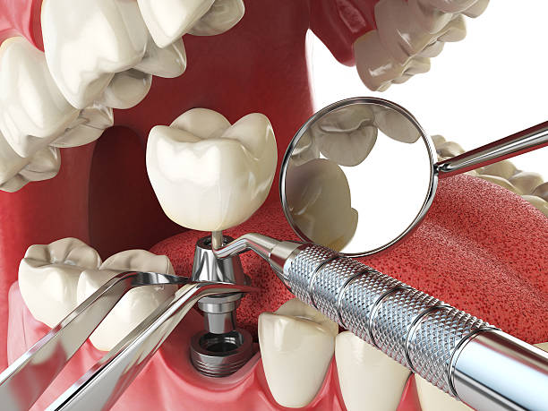 Best Emergency Dental Surgery in Angier, NC